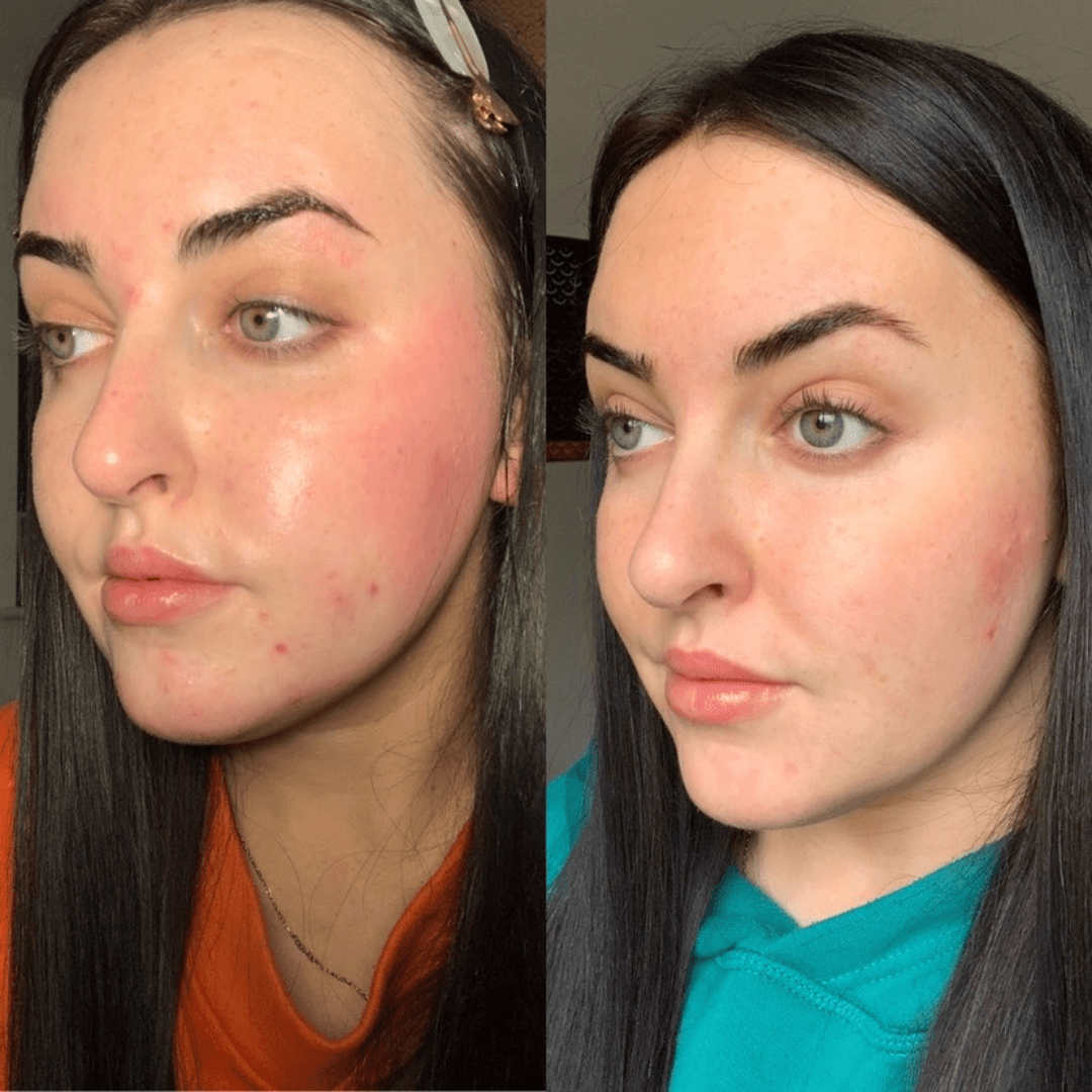 Unfiltered Facial Serum - NAKED GLOW